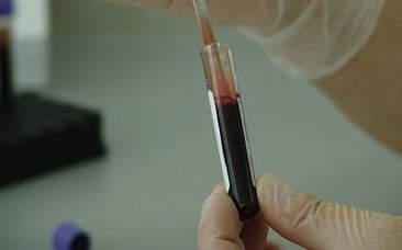 Распространение ВИЧ в России: ситуация ухудшается
